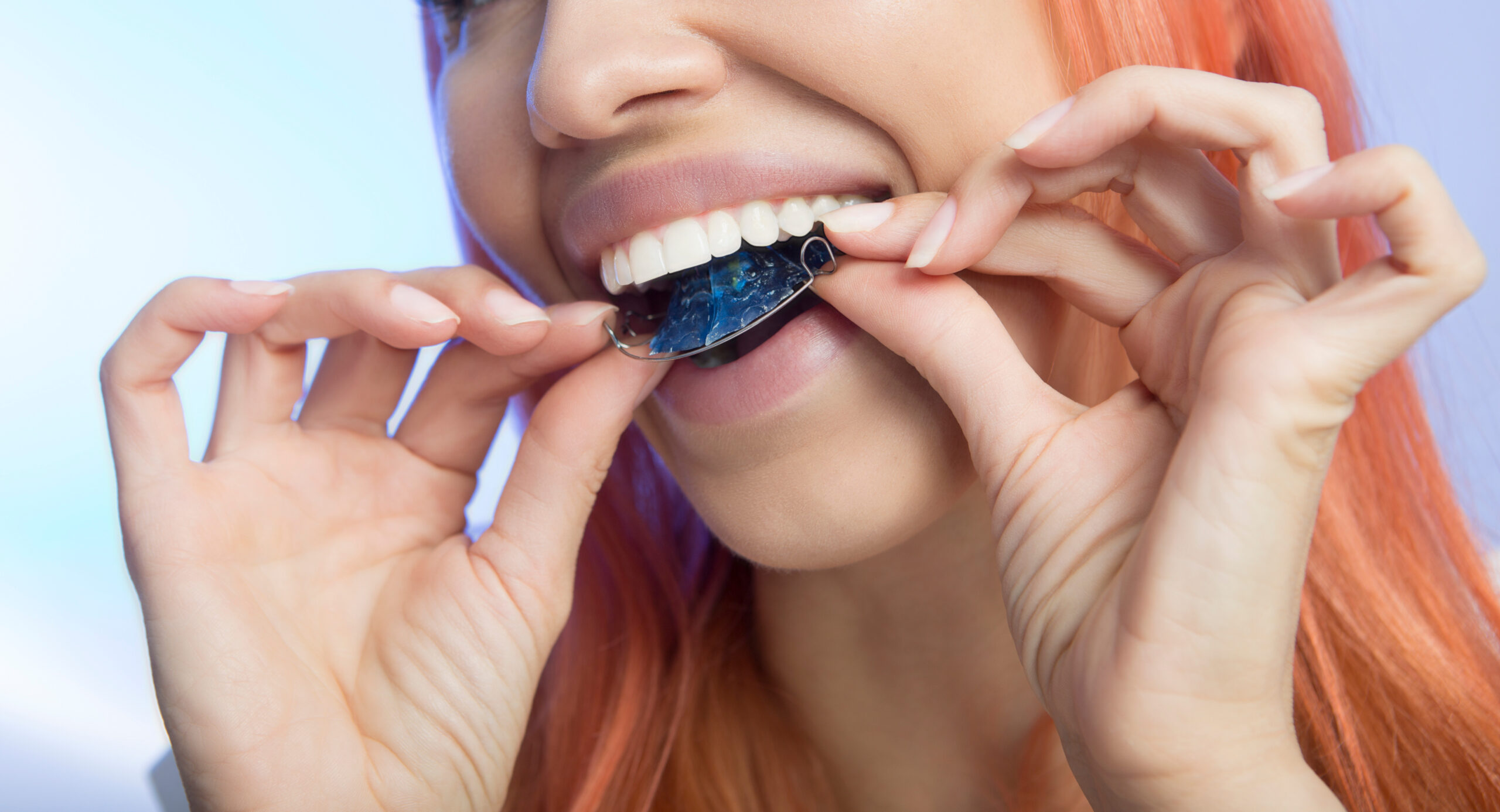 Invisalign for Teens