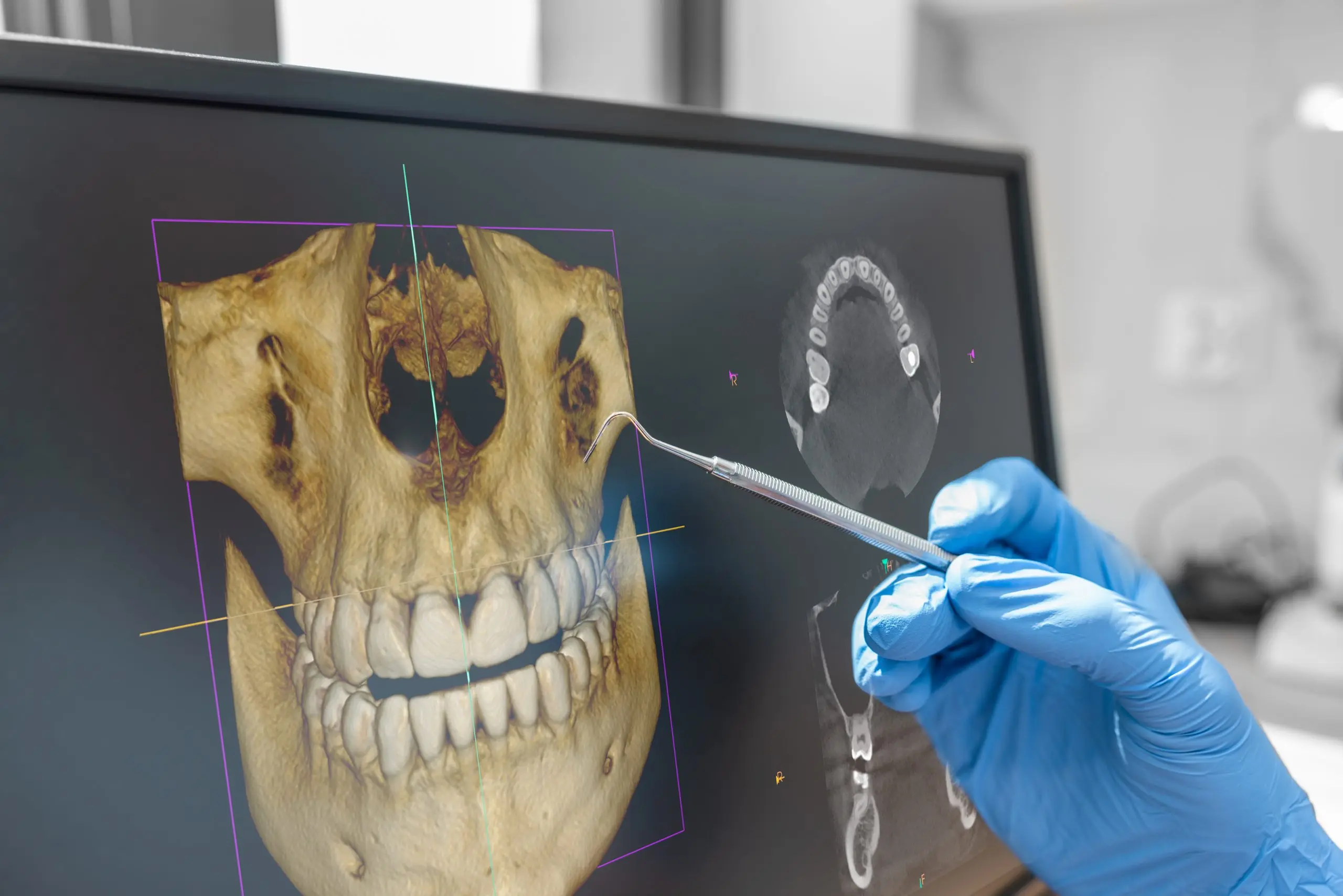 Why Some of the Highest Quality Dental Implants Are Titanium