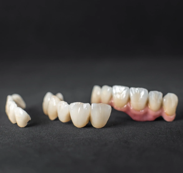 Same Day Crowns